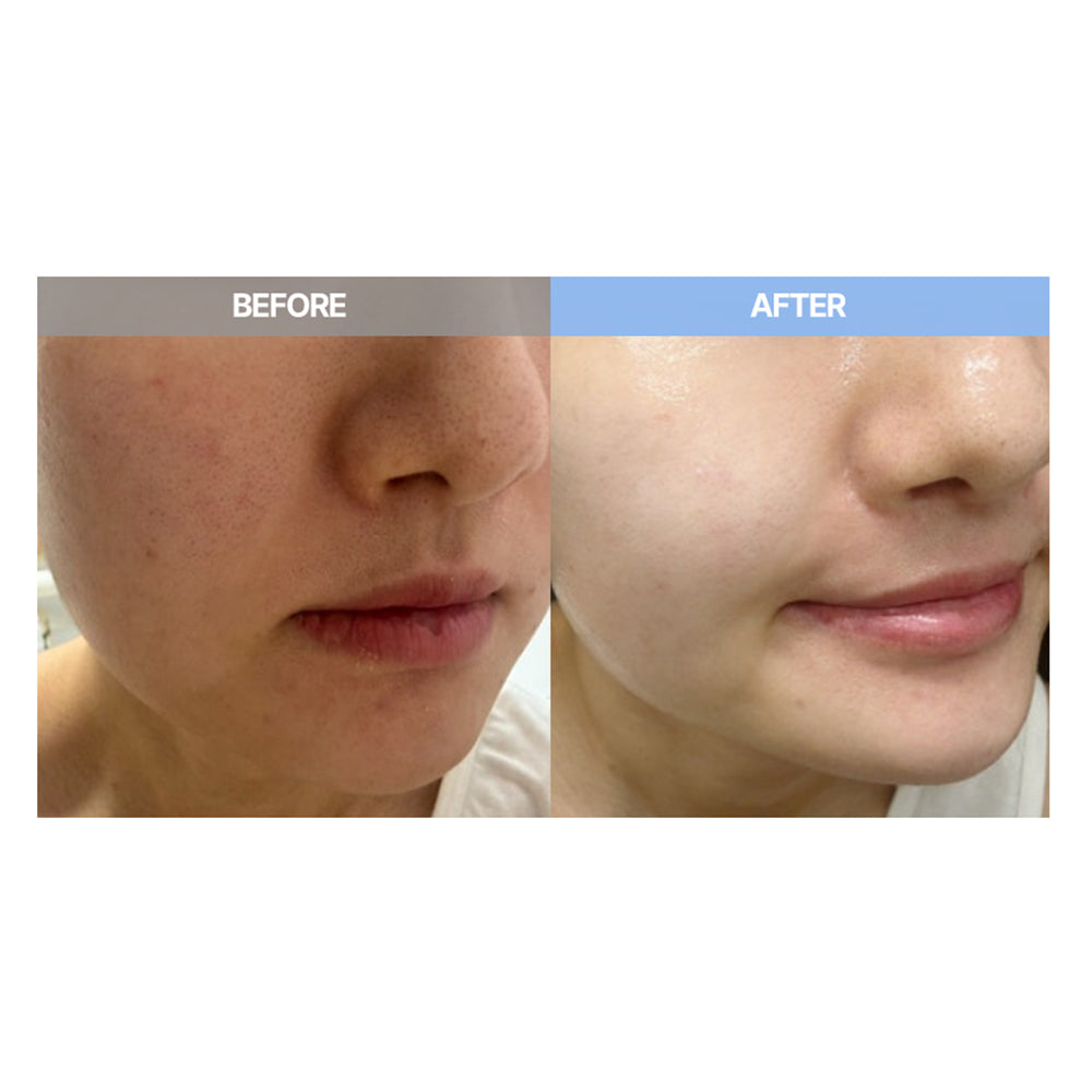 The YEON Korean Glutathione Wrapping Mask With Brush, 2.36 oz, Moisturizing, Hydrating