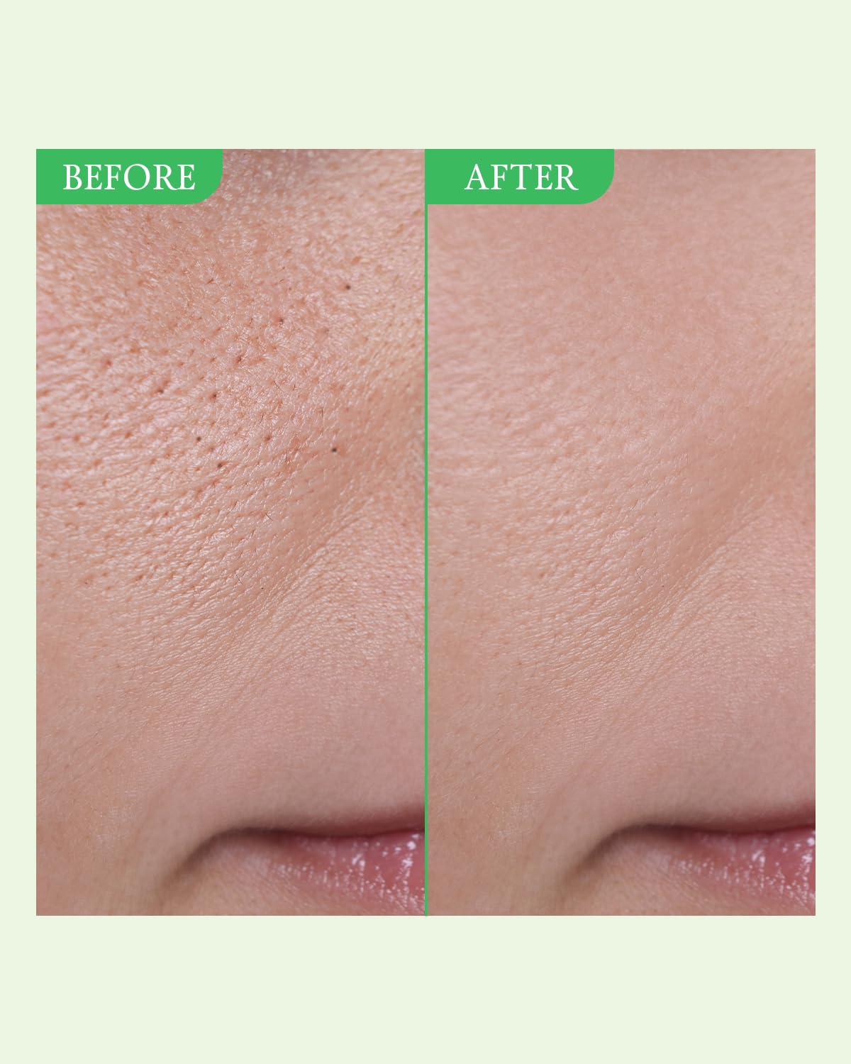 FULLY Green Tomato Serum, Pore Tightening with 67% Green Tomato Extract, Vit C and PHA, Elastcity Boosting and Skin Moisturization, Fragrance Free, Vegan & Dermatologically Tested, 1.01 fl.oz