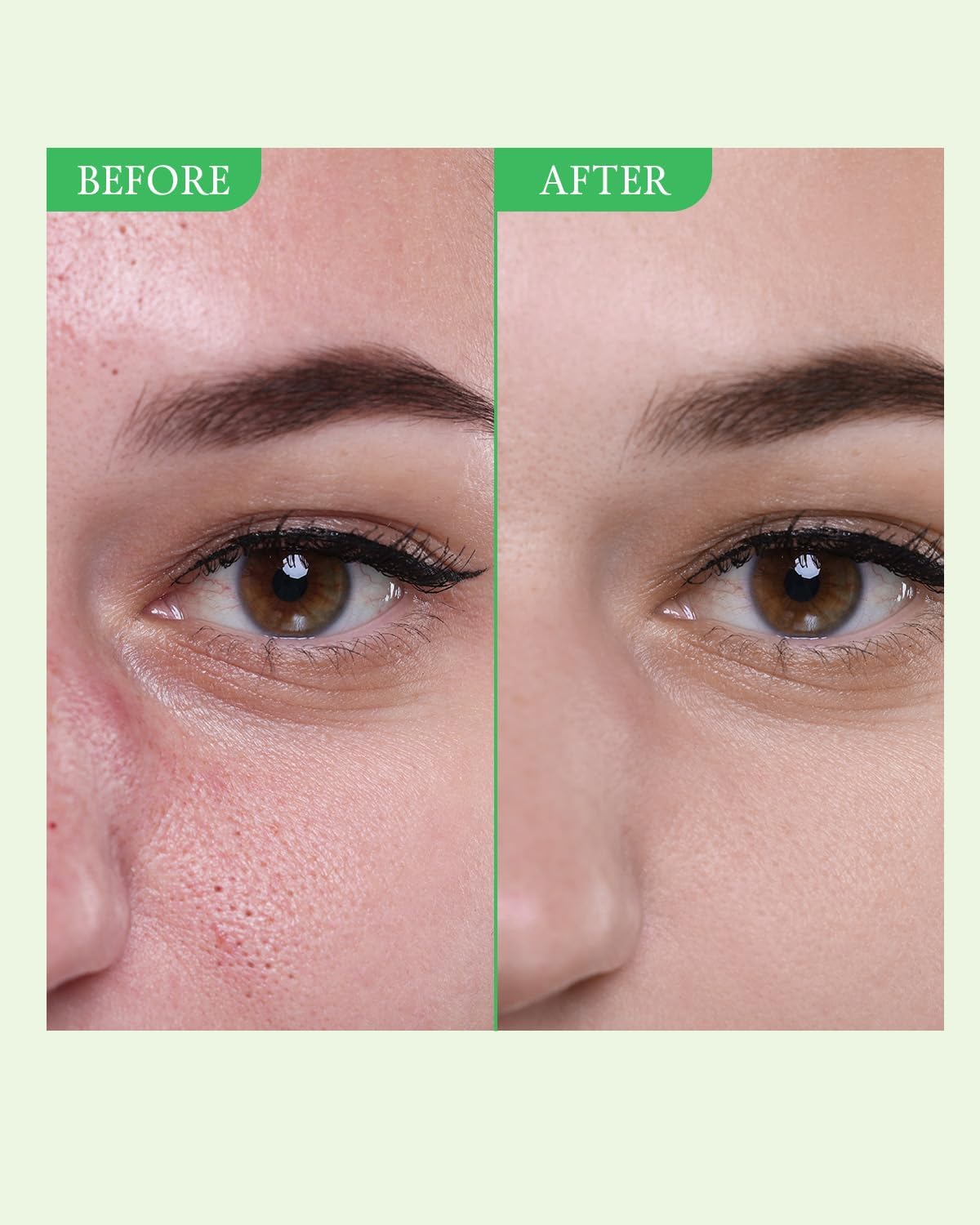 FULLY Green Tomato Toner, Pore Tightening with 95% Green Tomato Extract and VIT C, Skin Soothing and Hydrating, Fragrance Free, Vegan & Dermatologically Tested, 8.45 fl.oz