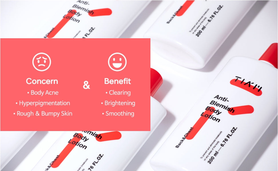 TIAM Anti-Blemish Body Lotion, Body Acne Treatment, Bacne, Great for Fighting Breakouts and Acne Scars Removal, 6.76 OZ