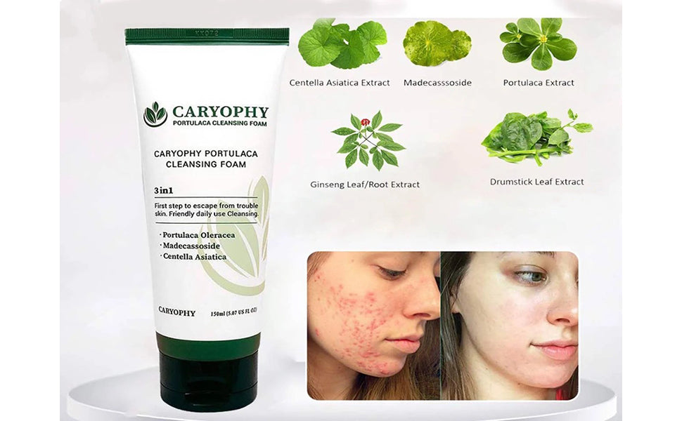 Caryophy Portulaca Cleansing Foam (150ml 5.07 fl oz.) 3 in 1, Portulaca Oleracea, Madecassoside, Centella Asiatica