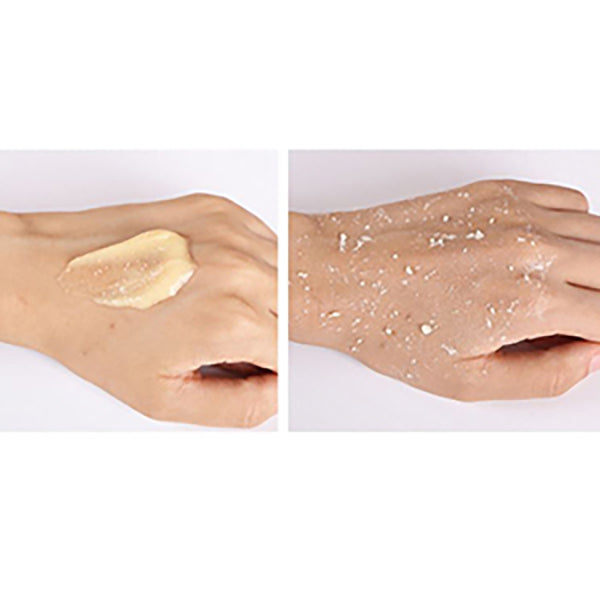 Zeesoon AHA BHA Exfoliating Cleansing Gel, Gentle Facial Cleanser for Dry & Troubled Skin, 3.38 fl.oz